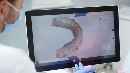 Refinamentos em ortodontia: por que eles prolongam o tratamento